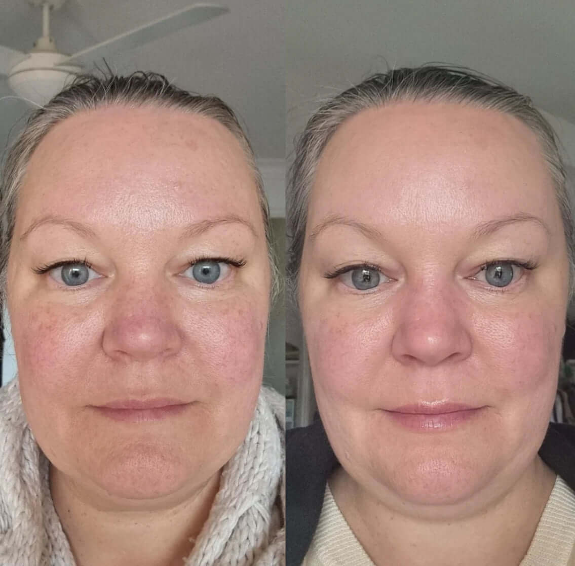 Eco by Sonya - Serum of Clear Skincare Luxurious Weddings