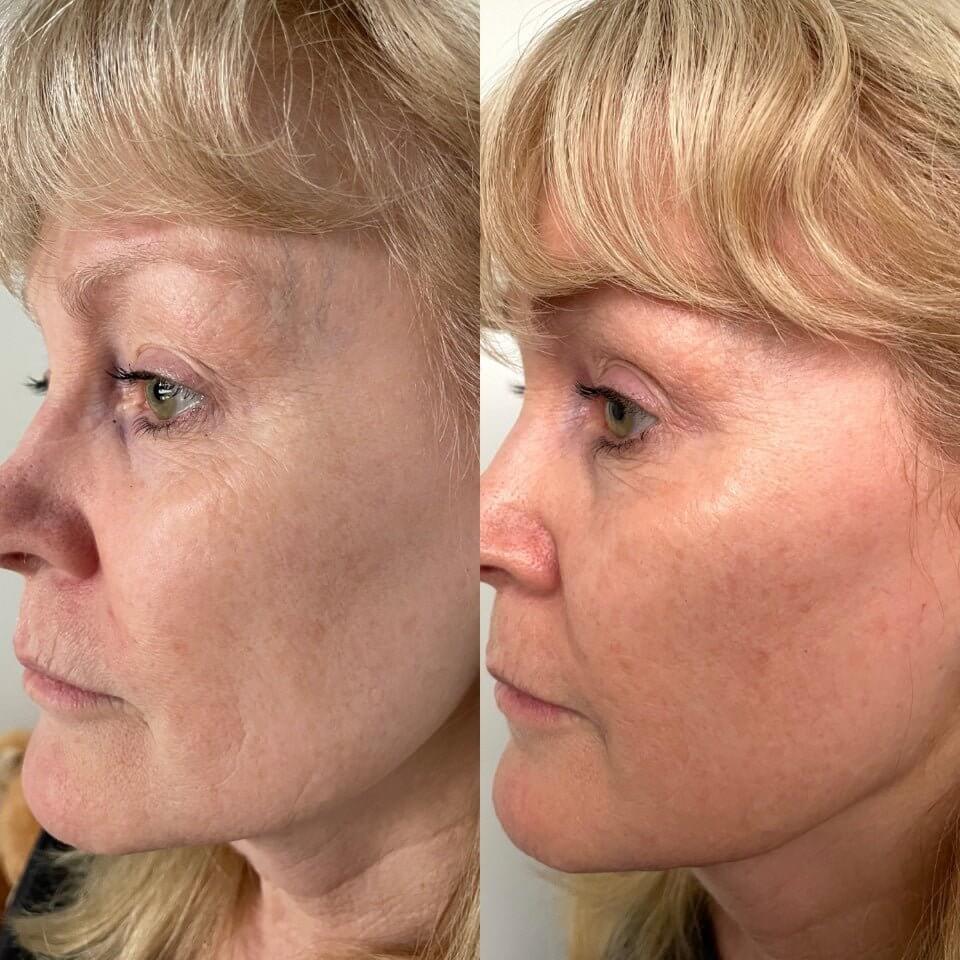 Serum of Plenty - Eco by Sonya Skincare Luxurious Weddings